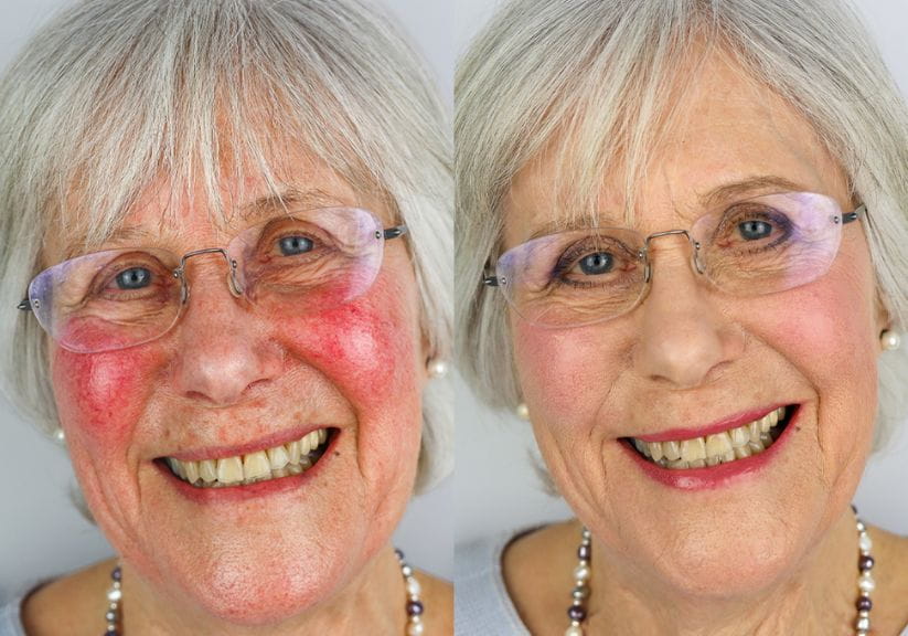 Before and after with the Look Fabulous Forever range