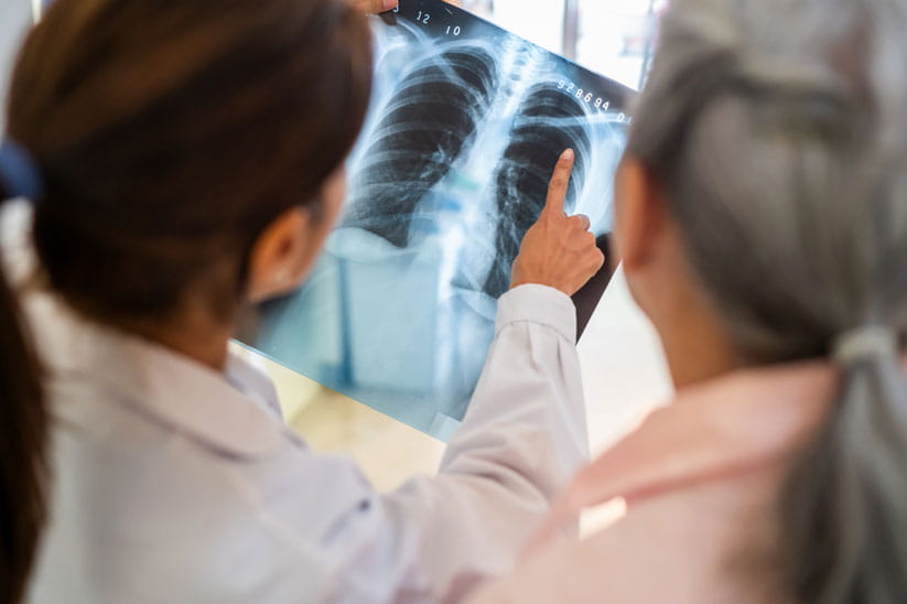 Older person with a doctor looking at a chest x-ray