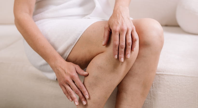 An older woman in a white dress sits on a sofa rubbing her calf