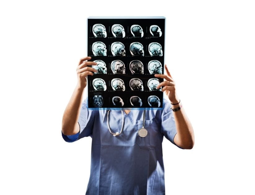 An image of a medical professional holding up different scans of the brain